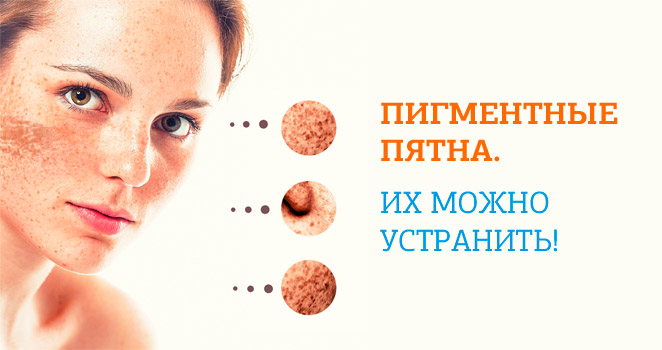 Пигментные-пятна1.jpg Пигментные-пятна1.jpg